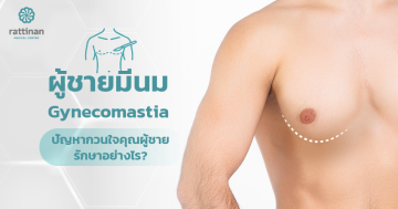 ภาวะเต้านมโตในผู้ชาย (gynecomastia)
