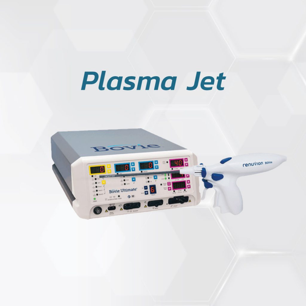 plasma jet